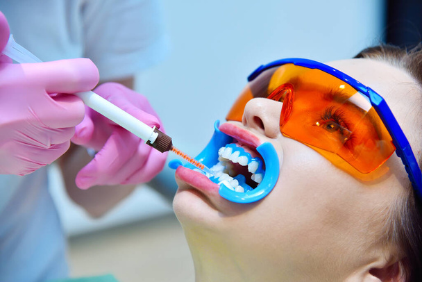 Woman dentist applies whitening gel to patient teeth in modern dental clinic. Teeth whitening in a dental clinic concept. - Φωτογραφία, εικόνα
