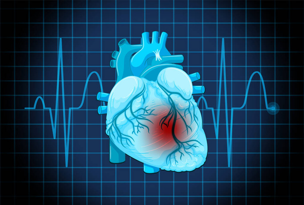 Human heart disease symbol illustration - Vektori, kuva