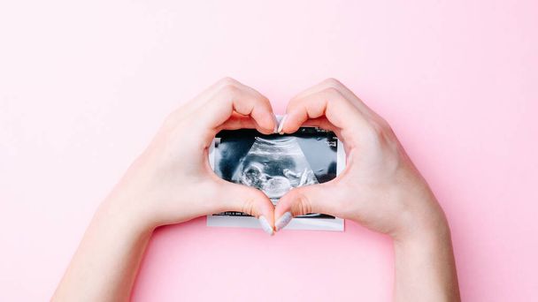 Zdjęcie USG dziecka w ciąży. Dłonie kobiety trzymające ultradźwiękowy obraz ciąży na różowym tle. Pojęcie ciąży, macierzyństwa, oczekiwania na poród dziecka - Zdjęcie, obraz