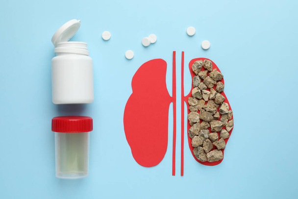Paper cutout of kidneys with stones, pills and urine test on light blue background, flat lay - Foto, imagen
