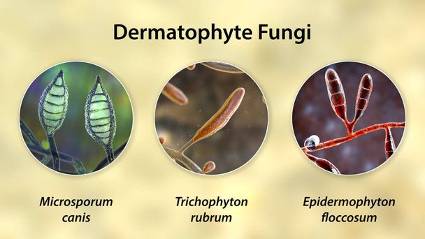 Champignons dermatophytes, illustration 3D. Microsporum, Trichophyton et Epidermophyton, les agents responsables de la teigne, de la tinée, des maladies de la peau, des cheveux et des ongles - Photo, image