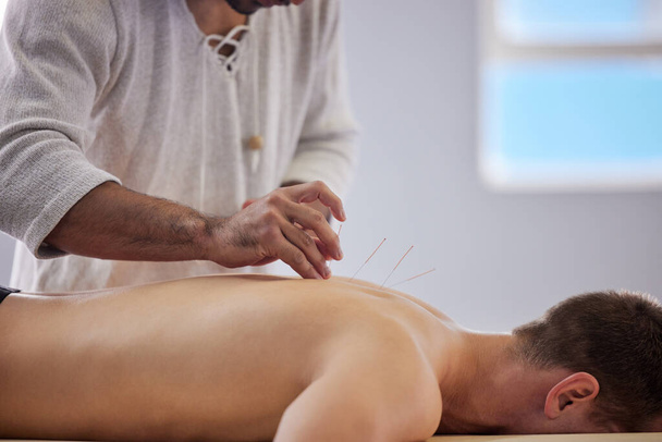 Ive never felt more relaxed. Shot of a acupuncturist treating a client. - Foto, immagini