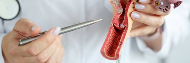 Врач-гинеколог показывает ручку на пластической модели матки и яичников крупным планом - Фото, изображение