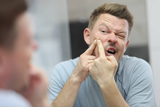 Hombre exprimir y deshacerse de grano en la cara mirando en el espejo - Foto, Imagen