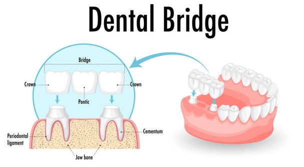 Infografinen ihmisen hammassillan valkoisella taustalla kuva - Vektori, kuva