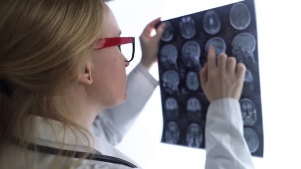 Эпилептолог изучает МРТ и электроэнцефалограмму пациента. Концепция лечения эпилепсии и помощи людям, которые страдают от этой болезни. Невролог на работе. Патология мозга. Судорожная активность - Кадры, видео