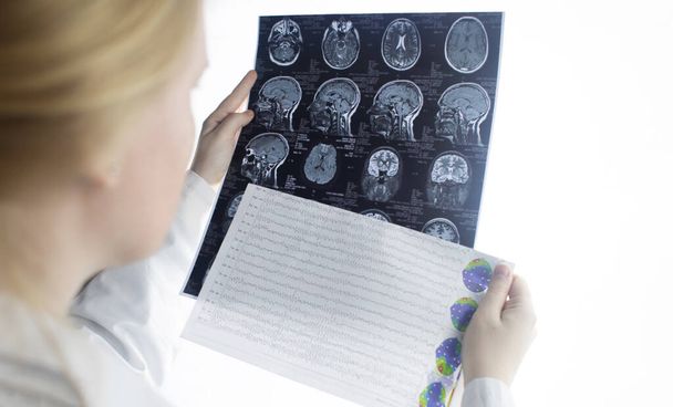 Epileptologist examines patient MRI and electroencephalogram. Concept treating epilepsy and helping people who suffer from this disease. Neurologist at work. Pathology of the brain. Seizure activity - Photo, Image