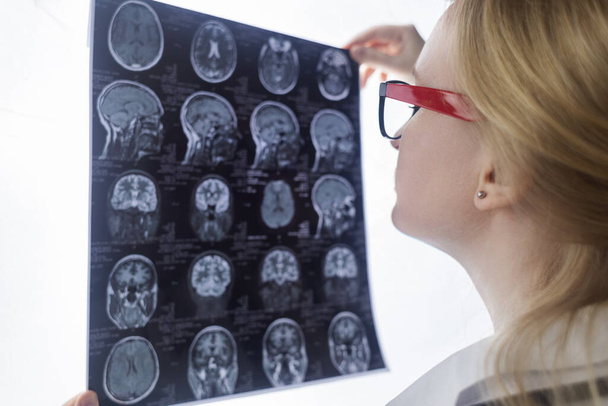 Epileptolog vyšetřuje pacientův MRI a elektroencefalogram. Koncept léčby epilepsie a pomoci lidem, kteří trpí touto nemocí. Neurolog v práci. Patologie v mozku. Záchvaty - Fotografie, Obrázek