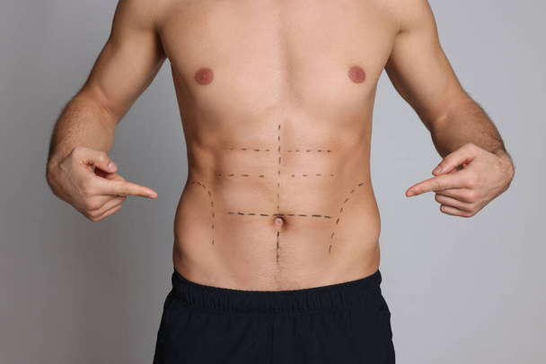 Fit man with marks on body against grey background, closeup. Weight loss surgery - Photo, Image