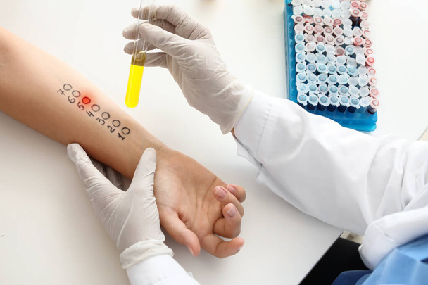 Молодая женщина проходит процедуру аллергенных кожных тестов в клинике - Фото, изображение