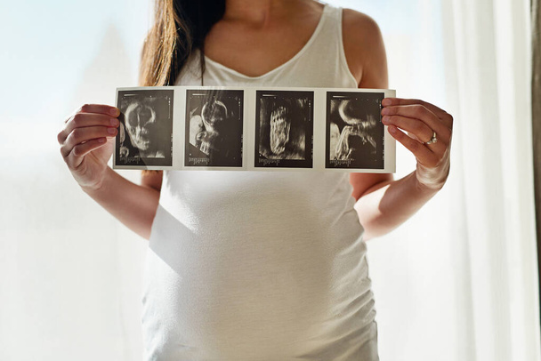 Babys first portrait. Shot of an unidentifiable pregnant woman holding up a series of ultrasound pictures in front of a window at home. - Photo, Image