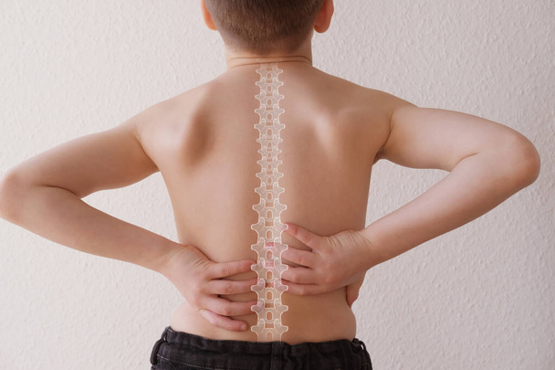 naked back of boy, child 8-10 years old grabbed a sore spot, curved spine, pain in spine, concept of therapeutic massage for osteochondrosis, scoliosis, back pain, intervertebral hernia - Фото, изображение