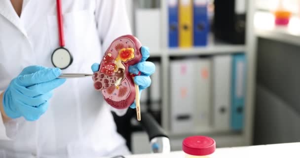 Nephrologist holding model of human kidney in clinic - Footage, Video