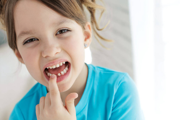 The kid lost a tooth. Baby without a tooth. Portrait of a little girl no tooth. - Foto, Imagem