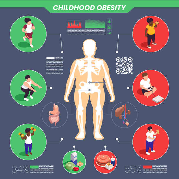 Gyermekkori elhízás infografika készlet százalékos és statisztika szimbólumok izometrikus vektor illusztráció - Vektor, kép