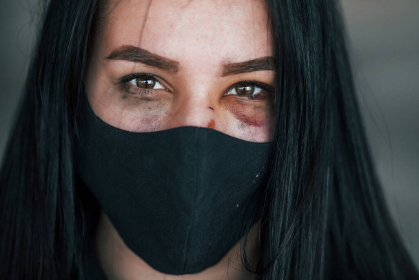 Portrait of beaten young woman in black protective mask with bruise under eye indoors in abandoned building. - Фото, зображення