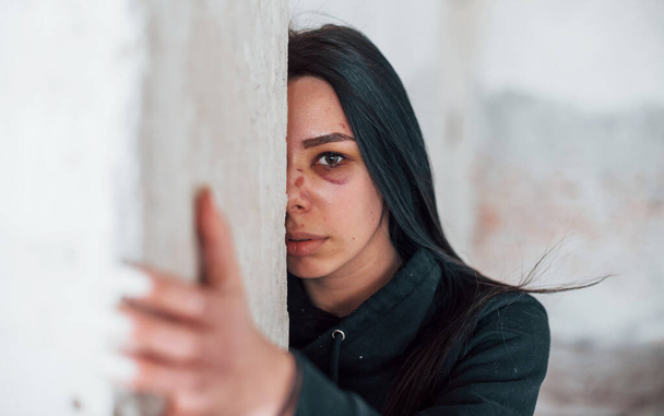 Portrait of beaten young woman with bruise under eye that standing and leaning on the wall indoors in abandoned building. - Foto, imagen