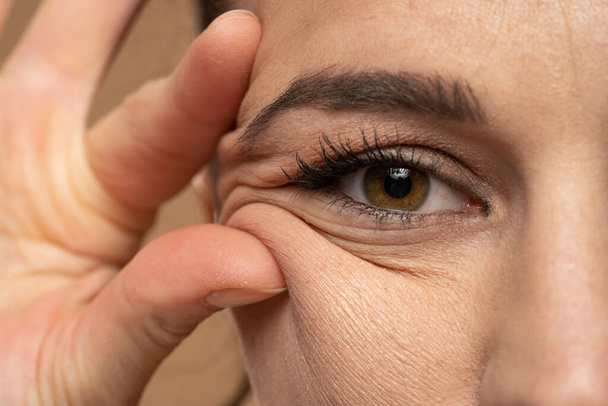 nő mutatja a szemét ráncok ujjaival fehér háttér. - Fotó, kép