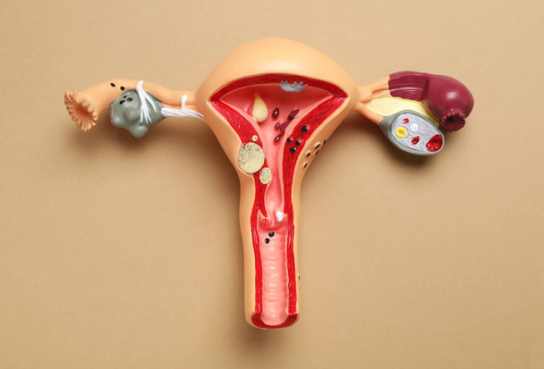 Model of female reproductive system on light brown background, top view. Gynecological care - Foto, Bild