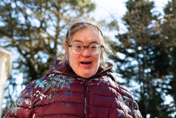 Close up outdoor portrait of a 39 year old white woman with Down Syndrome, Belgium - Foto, afbeelding