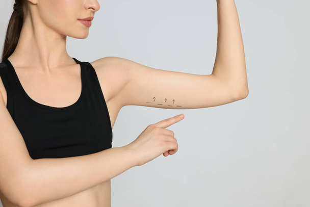 Slim young woman with marks on arm against light background, closeup. Weight loss surgery - Photo, image