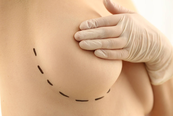 Woman close nipple with hand, linear marking on boob, cosmetic surgery operation - Φωτογραφία, εικόνα