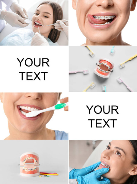 Set of women with dental braces, tooth bushes and models of jaw - Photo, image