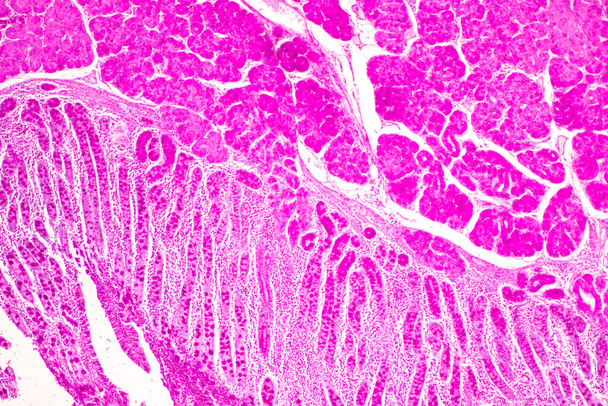 Tissue of Small intestine (Duodenum) and Vermiform appendix  Human under the microscope in Lab. - Photo, Image