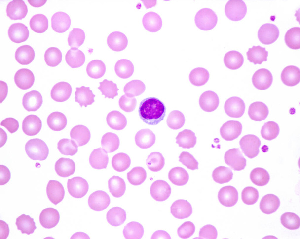 Emberi vérkenet, ahol limfocitát figyeltek meg. A kis kék pontok a vörösvértestek között vérlemezkék.. - Fotó, kép