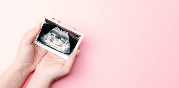 Echografie foto zwangerschap baby. Vrouw handen houden echografie zwangere foto op roze achtergrond. Concept moederschap, zwangerschap, bevalling - Foto, afbeelding