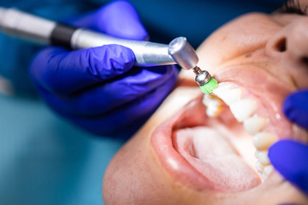 dentista irriconoscibile con spazzola lucidante dentale per lucidare e pulire i denti di una paziente femminile - Foto, immagini