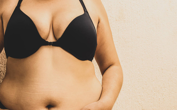 La parte superiore del corpo della donna grassa in lingerie. Forziere e addome. - Foto, immagini