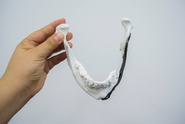 Persona sosteniendo en la mano endoprosthese mandibular facial impresa impresora 3D de metal - Foto, Imagen