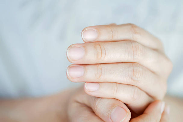 Close-up van de nagels en handen van de vrouw. Nagel gezondheidszorg concept. - Foto, afbeelding