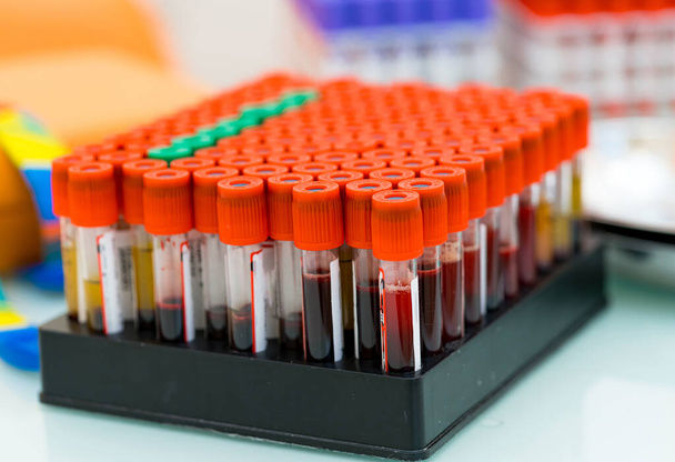 Hospital blood analyzing samples. Blood test tubes close up in laboratory. - Fotó, kép