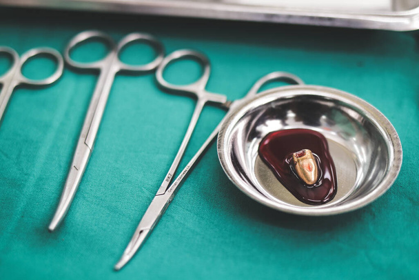 Der Chirurg entfernt die Kugel aus dem Körper des Patienten im Operationssaal des Krankenhauses. Unfallkonzept Notfallchirurgie - Foto, Bild