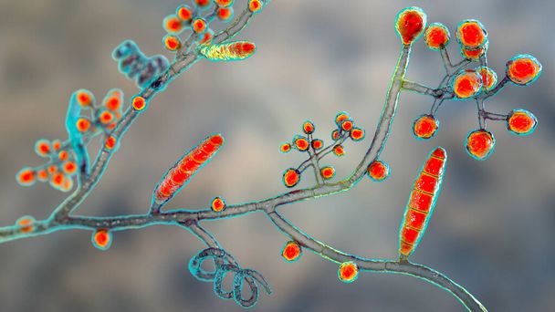 Pilze Trichophyton mentagrophytes, 3D-Illustration mit Makrokonidien, verzweigten Konidiophoren mit sphärischen Konidien, Septate und Spiralhyphen. Verursacht Ringelwurm, Haar- und Nagelinfektionen - Foto, Bild