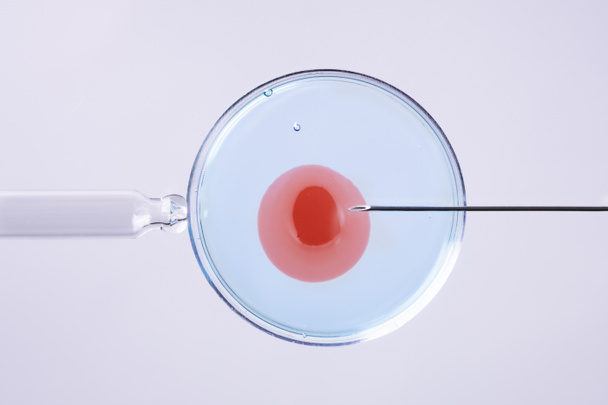 Concept de fécondation in vitro. Insémination artificielle ou traitement de fertilité macro photographie.  - Photo, image