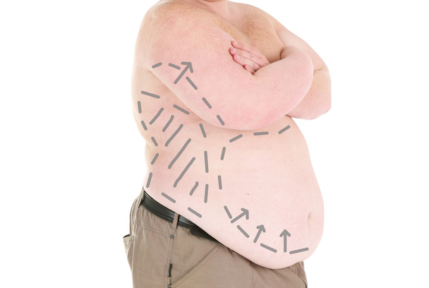 Fat man marked with lines - Foto, Imagem