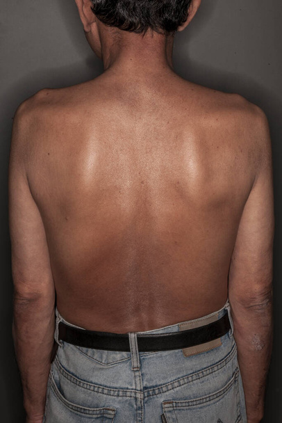 old man show his back body - Fotó, kép
