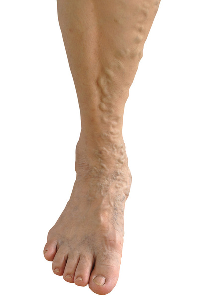 Viejo Asia mujer pierna
 - Foto, imagen