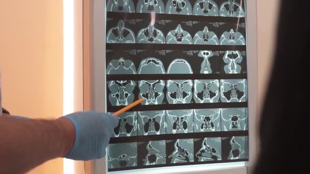 Доктор показує результати комп'ютерної томографії, що вказує на ручку
 - Кадри, відео