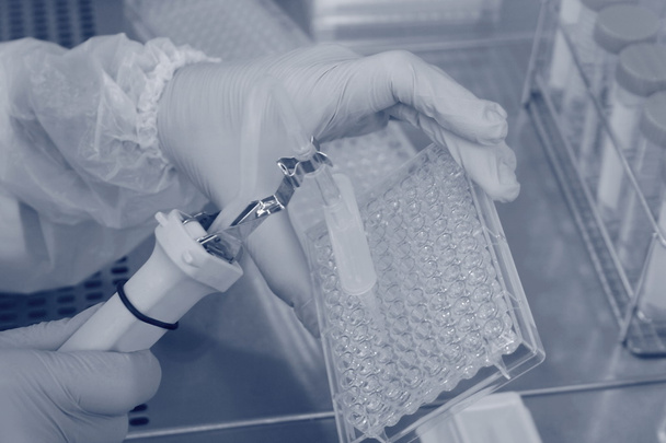 Trabajador de laboratorio en guantes protectores haciendo muestras de prueba con pipeta
 - Foto, imagen