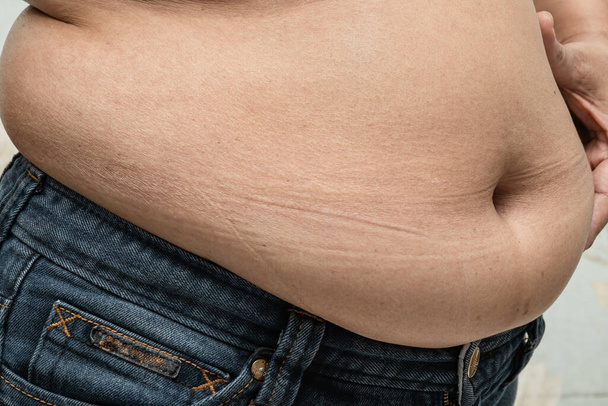 Sovrappeso donna asiatica mostrano pancia grassa per bruciare e perdere peso e limitare le calorie. - Foto, immagini