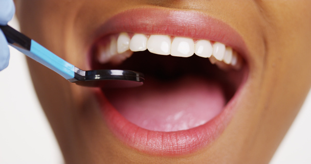 Gros plan de la femme noire souriante chez le dentiste
 - Photo, image