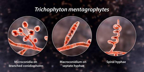 Houby Trichophyton mentagrophytes, 3D ilustrace znázorňující rozvětvené conidiofory nesoucí sférické mikroconidium, makrokonidium, septát a spirální hyfy. Způsobuje infekce prstence, vlasů a nehtů - Fotografie, Obrázek