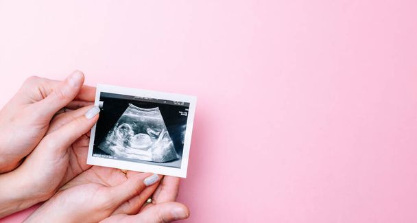 Ultrasound photo pregnancy baby. Woman hands holding ultrasound pregnant picture on pink background. Concept maternity, pregnancy, childbirth - 写真・画像