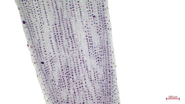 Light photomicrograph of Mitosis in oion root tip cells seen through microscope. Un bout de racine d'oignon est une partie en croissance rapide d'un oignon et ainsi beaucoup de cellules seront dans différents stades de la mitose. - Photo, image