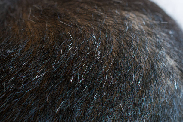 Vista recortada de la cabeza de los hombres asiáticos con pocos canas creciendo. El cabello se vuelve blanco cuando las células de pigmentación responsables del color (melanina) dejan de producirse. - Foto, imagen