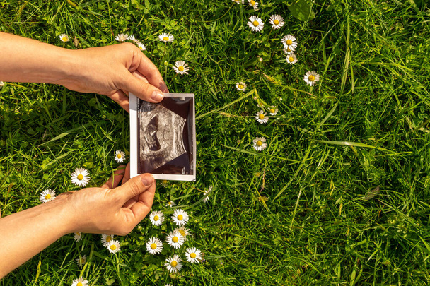 Ultrahang kép terhes baba fotó. Nő kezében ultrahang terhesség kép fű virág háttér. A terhesség, az anyaság és a szülés várható fogalma - Fotó, kép